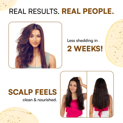 Hair Pro+ Booster | Natural Hair Growth Formula with Rosemary, Batana & Biotin